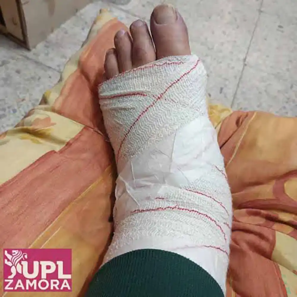 UPL exige a la Junta una fecha concreta para instalar los nuevos equipos de rayos X en el Centro de Salud de Aliste 1 UPL exige a la Junta una fecha concreta para instalar los nuevos equipos de rayos X en el Centro de Salud de Aliste
